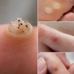🔥 Родинка начала меняться? 7 признаков на коже, которые нельзя игнорировать